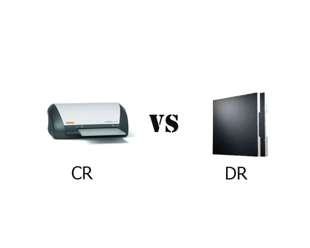 رادیوگرافی کامپیوتری CR یا رادیوگرافی دیجیتال DR